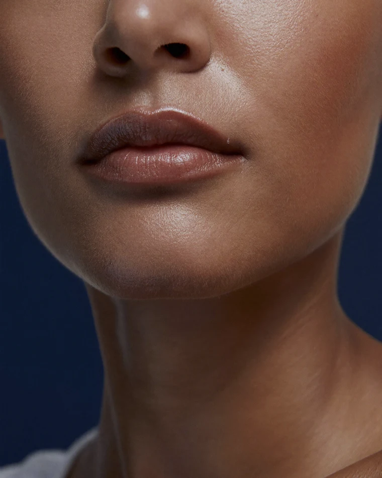 Dermal Fillers in Miami