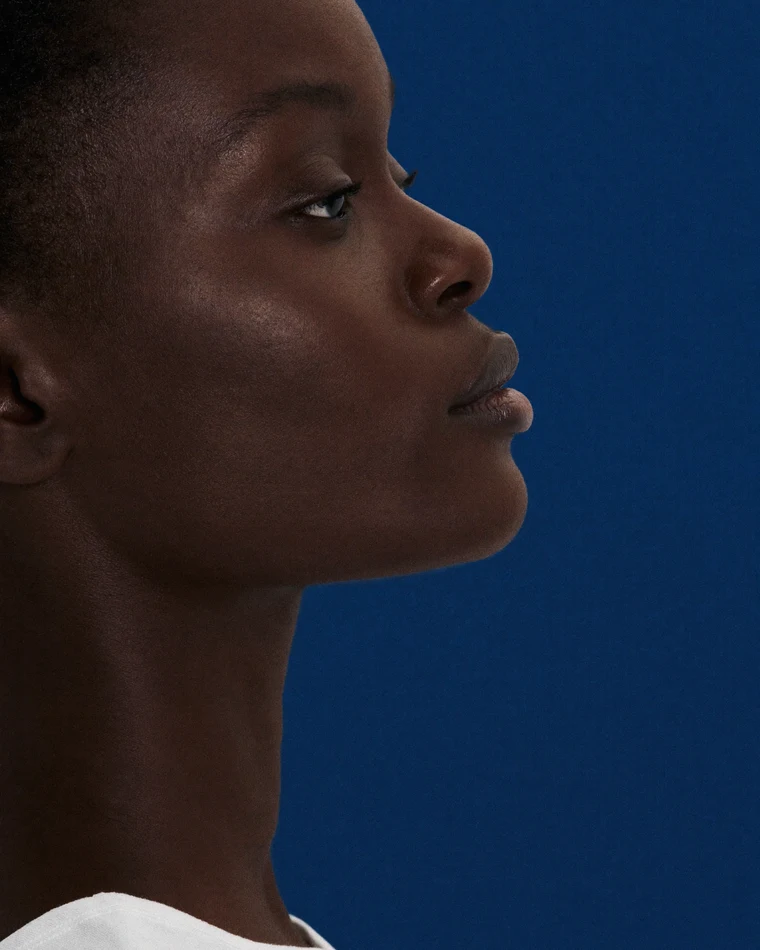 Rhinoplasty